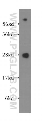 CBX5 Antibody in Western Blot (WB)