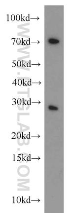 CBX5 Antibody in Western Blot (WB)