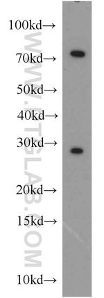 CBX5 Antibody in Western Blot (WB)