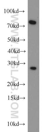 CBX5 Antibody in Western Blot (WB)