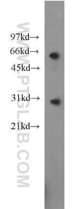 CBX5 Antibody in Western Blot (WB)