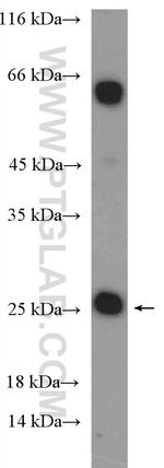 CBX5 Antibody in Western Blot (WB)