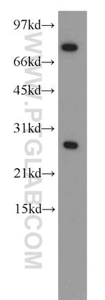 CBX5 Antibody in Western Blot (WB)