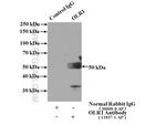 OLR1 Antibody in Immunoprecipitation (IP)