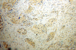 SDCCAG1 Antibody in Immunohistochemistry (Paraffin) (IHC (P))