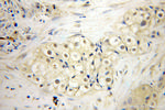 SDCCAG1 Antibody in Immunohistochemistry (Paraffin) (IHC (P))