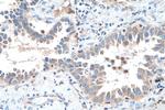 SDCCAG1 Antibody in Immunohistochemistry (Paraffin) (IHC (P))