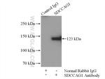 SDCCAG1 Antibody in Immunoprecipitation (IP)