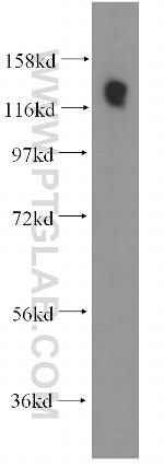 SDCCAG1 Antibody in Western Blot (WB)