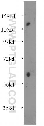SDCCAG1 Antibody in Western Blot (WB)