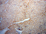 RBP5 Antibody in Immunohistochemistry (Paraffin) (IHC (P))