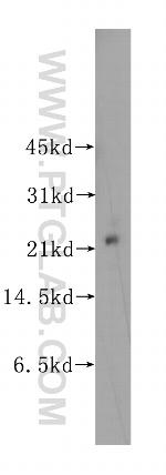 UBE2E2 Antibody in Western Blot (WB)