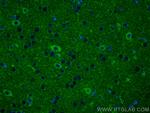 SRPX2 Antibody in Immunohistochemistry (PFA fixed) (IHC (PFA))