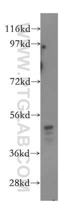 SRPX2 Antibody in Western Blot (WB)