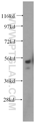 SRPX2 Antibody in Western Blot (WB)