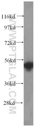 SRPX2 Antibody in Western Blot (WB)