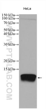 SPCS1 Antibody in Western Blot (WB)