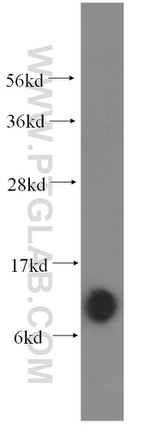 SPCS1 Antibody in Western Blot (WB)