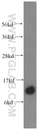 SPCS1 Antibody in Western Blot (WB)