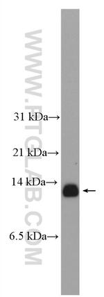 SPCS1 Antibody in Western Blot (WB)