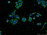 Cofilin 2 Antibody in Immunocytochemistry (ICC/IF)