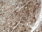 Cofilin 2 Antibody in Immunohistochemistry (Paraffin) (IHC (P))