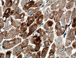 Cofilin 2 Antibody in Immunohistochemistry (Paraffin) (IHC (P))