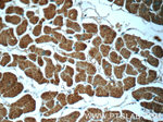 Cofilin 2 Antibody in Immunohistochemistry (Paraffin) (IHC (P))