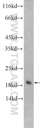 Cofilin 2 Antibody in Western Blot (WB)