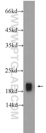 Cofilin 2 Antibody in Western Blot (WB)