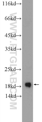 Cofilin 2 Antibody in Western Blot (WB)