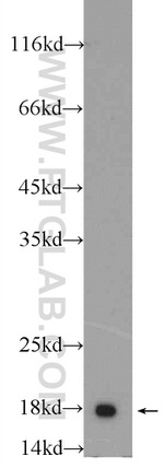 Cofilin 2 Antibody in Western Blot (WB)