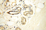 SFTPA1 Antibody in Immunohistochemistry (Paraffin) (IHC (P))