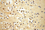 SFTPA1 Antibody in Immunohistochemistry (Paraffin) (IHC (P))