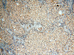 SFTPA1 Antibody in Immunohistochemistry (Paraffin) (IHC (P))