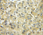 SFTPA1 Antibody in Immunohistochemistry (Paraffin) (IHC (P))