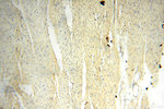 SFTPA1 Antibody in Immunohistochemistry (Paraffin) (IHC (P))