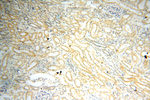 SFTPA1 Antibody in Immunohistochemistry (Paraffin) (IHC (P))