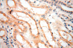 SFTPA1 Antibody in Immunohistochemistry (Paraffin) (IHC (P))