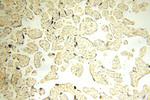 SFTPA1 Antibody in Immunohistochemistry (Paraffin) (IHC (P))