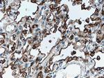 SFTPA1 Antibody in Immunohistochemistry (Paraffin) (IHC (P))