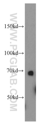 SERPINA10 Antibody in Western Blot (WB)