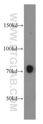 SERPINA10 Antibody in Western Blot (WB)