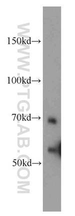 SERPINA10 Antibody in Western Blot (WB)