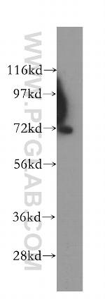 SERPINA10 Antibody in Western Blot (WB)