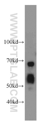 SERPINA10 Antibody in Western Blot (WB)