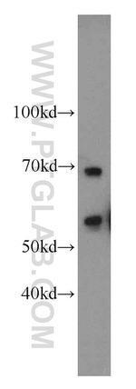 SERPINA10 Antibody in Western Blot (WB)