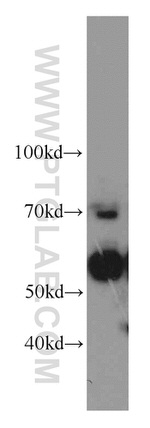 SERPINA10 Antibody in Western Blot (WB)