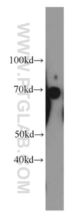 SERPINA10 Antibody in Western Blot (WB)