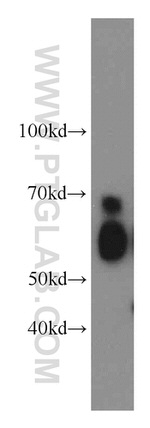 SERPINA10 Antibody in Western Blot (WB)